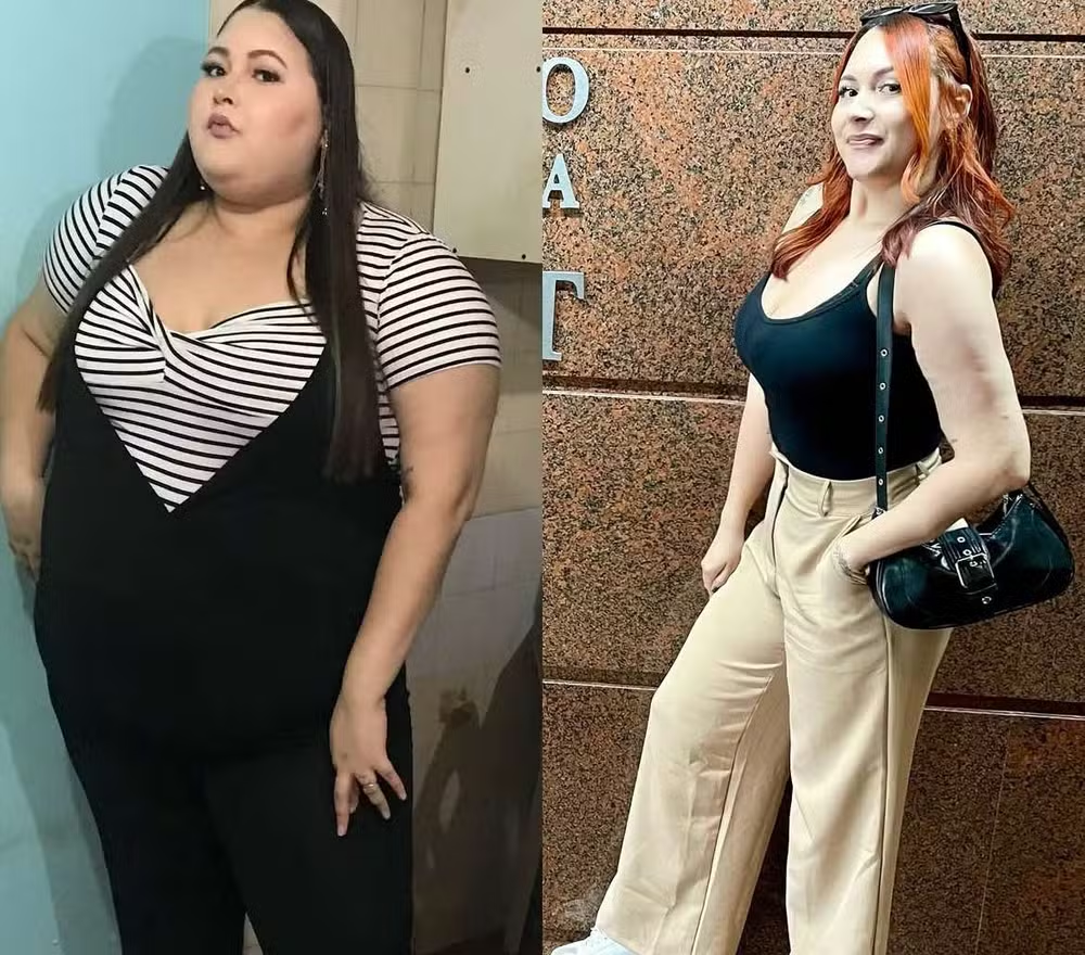 Casal perde quase 200 kg juntos - Larissa
