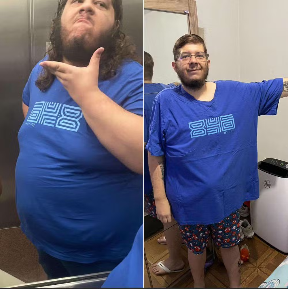 Casal perde quase 200 kg juntos - Alex